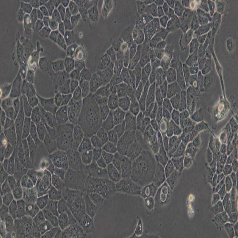 人表皮癌細(xì)胞（A431）